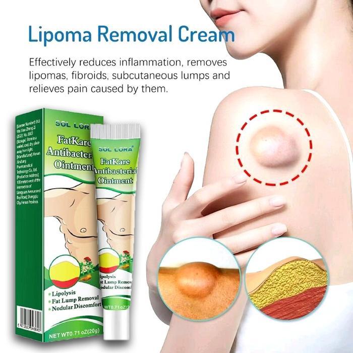 Original-Lipoma Cream 20g Herbal Ampuh Lipoma Cream Salep Benjolan 7 Days Lipoma Removal Cream-Salep