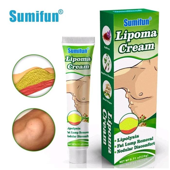 Lipoma Cream 20gr Salep Lipoma Cream Tubuh