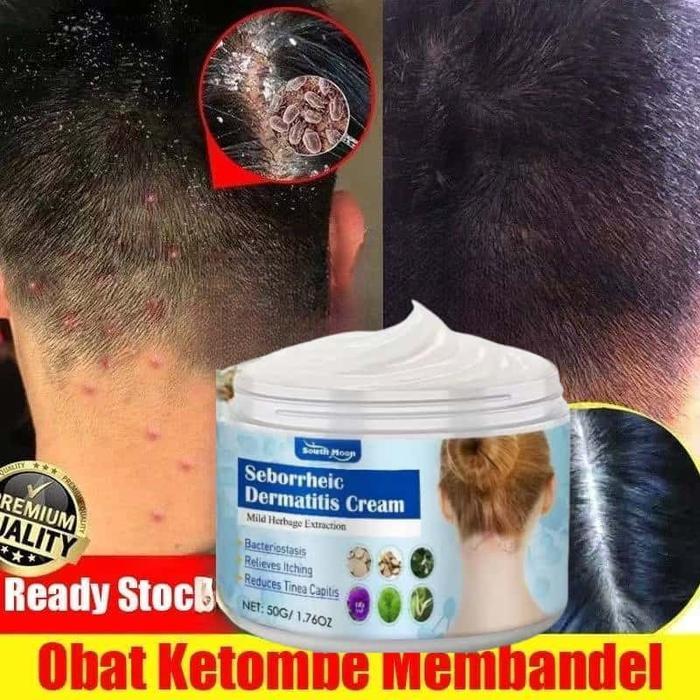 Obat Ketombe & Kulit Kepala Gatal [Formula Kuat] - Atasi Ketombe Membandel, Bersisik & Berkerak