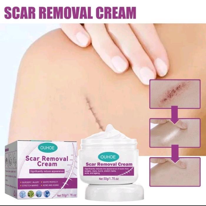 OUHOE Scar Remover Cream Penghilang Bekas Luka/Koreng/Penghilang Luka