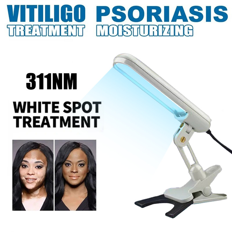 Uvb Narrowband Phototherapy Lamp 311Nm Ultraviolet Lamp For Vitiligo Uv Narrowband Medical Light