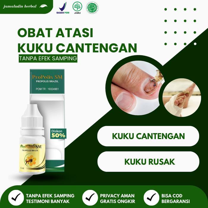 OBAT CANTENGAN YANG MEMBENGKAK - OBAT LUKA BERNANAH PADA JEMPOL KAKI