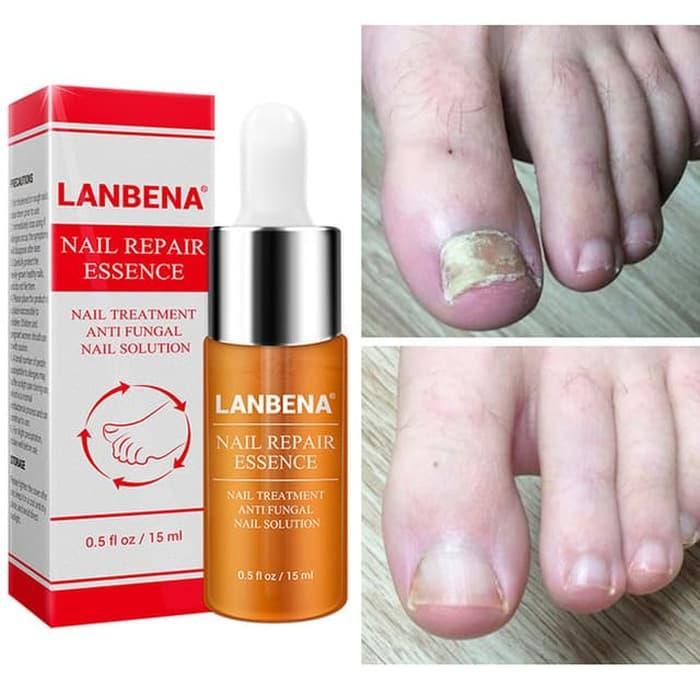LANBENA NAIL REPAIR ESSENCE / NAIL SERUM / SERUM JAMUR KUKU ORIGINAL