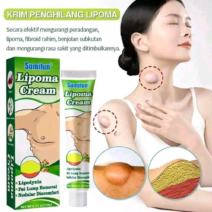 Sumifun Lipoma Cream salep Benjolan 20g Lipoma Krim Benjolan Di Leher Pungggung Kaki