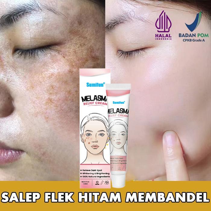 Krim penghilang flek hitam cream flek hitam membandel salep flek hitam membandel 20g menghilangkan