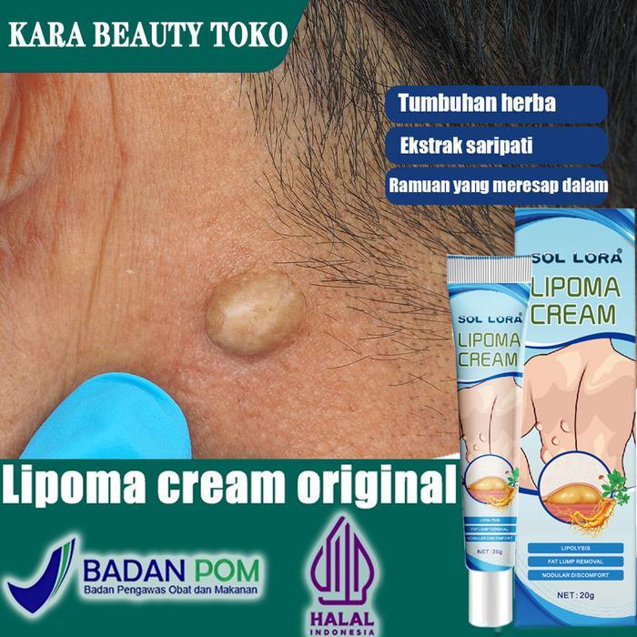 salep lipoma salep benjolan Cream Obat Benjolan Lipoma 20gr-Perawatan kulit Salep Lipoma untuk