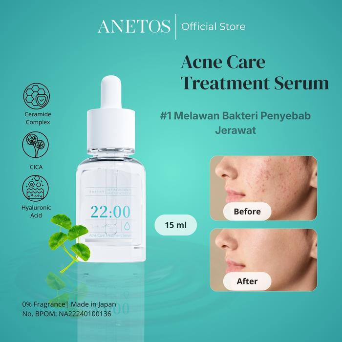 DISKON ANETOS Serum Jerawat 15ml Perawatan Wajah dengan Vitamin C, Menghaluskan & Mencerahkan Kulit