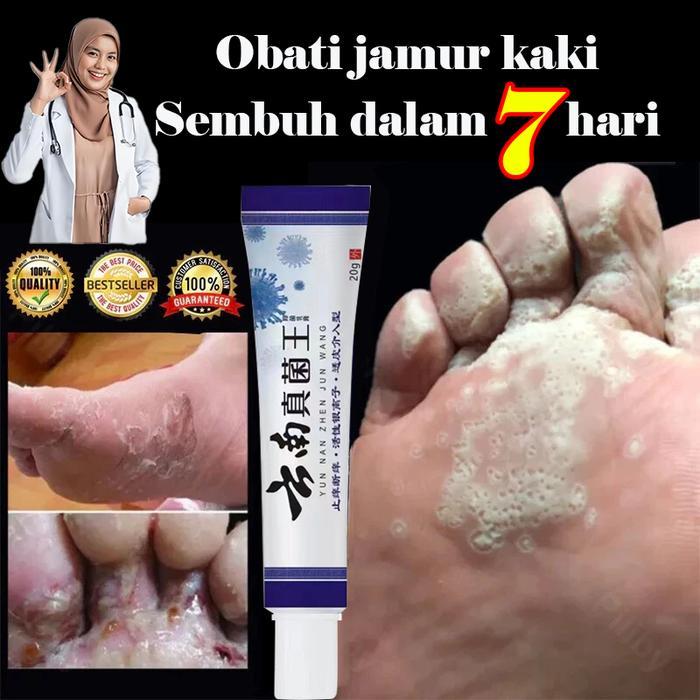 Krim Antibakteri Beri-Beri-Penghilang Bau Kaki Obat Jamur Kaki Obat Kaki Jamuran Pembersih Kulit