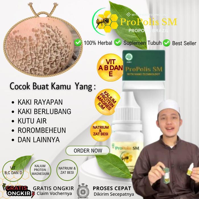 KAKI BOLONG-BOLONG, KAKI RAYAPAN, PITTED KERATOLYSIS, TELAPAK KAKI BERLUBANG DENGAN PROPOLIS SM