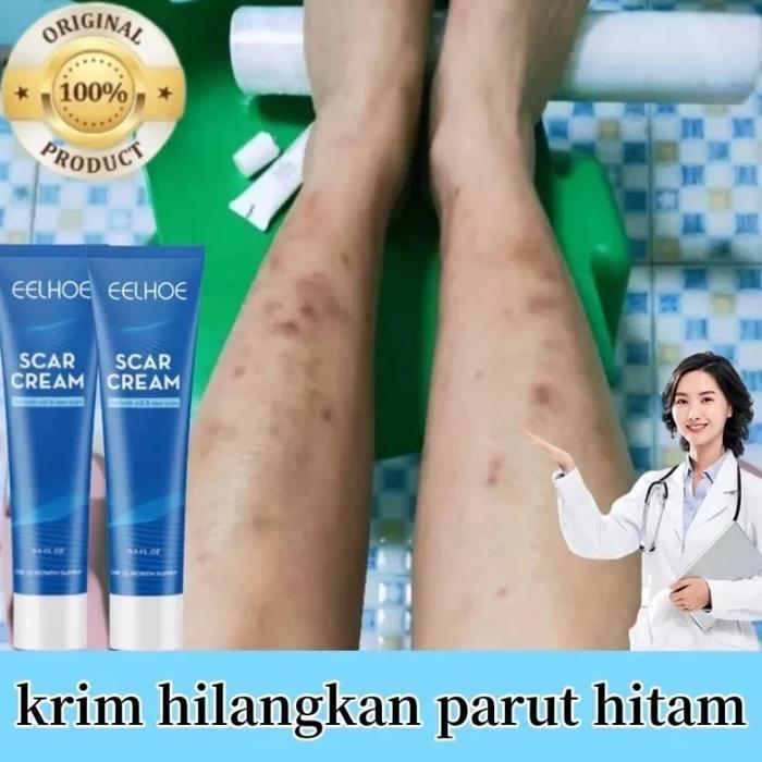 Penghilang Bekas Luka Gel Bekas Luka Canggih Obat Bekas Luka Bekas Luka Jahitan Bekas Luka Jerawat