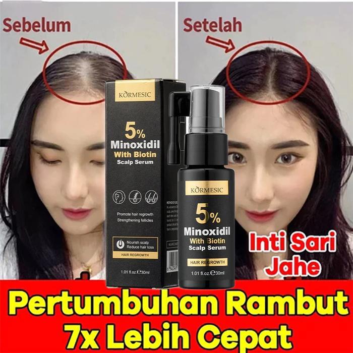 100% Minoxidil Penumbuh Rambut Obat Penumbuh Rambut Botak Tipis Dan Rontok Super Cepat Original 30ml