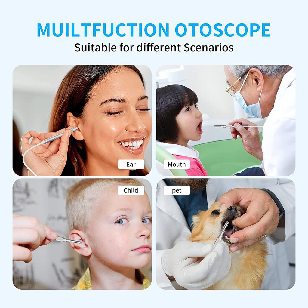 . 7 Inch Screen Digital Otoscope 3.9Mm 1080P Hd Ear Scope Endoscope Ear -