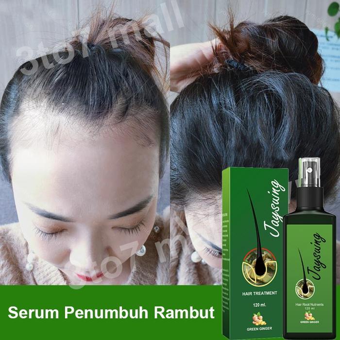 SERUM PENUMBUH RAMBUT HAIR GROWTH SPRAY OBAT PENUMBUH RAMBUT PENUMBUH RAMBUT BOTAK SERUM HAIR TONIC