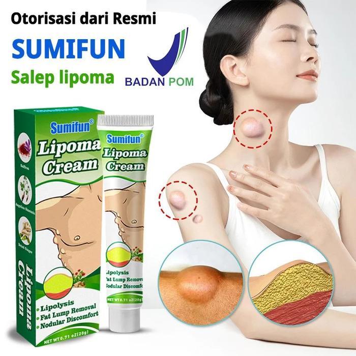 Krim Lipoma Krim Lipoma Obat Lipoma Obat Lipoma Benjolan payudara Benjolan tangan Benjolan leher