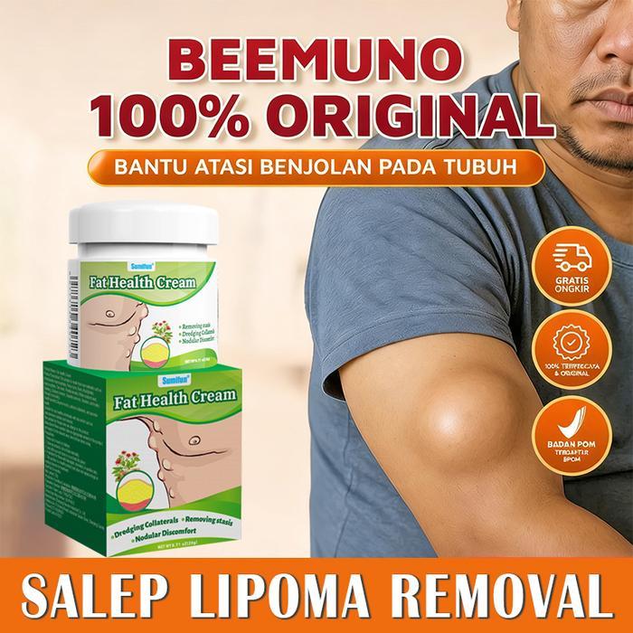 Salep lipoma Krim kista Salep benjolan 20g Krim Penghilang Lipoma Removal Lipoma Untuk sakit