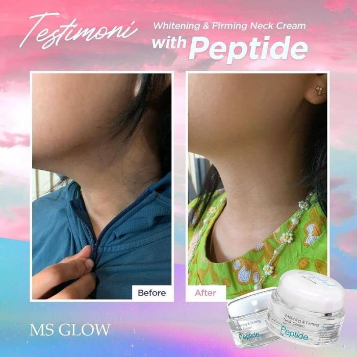 MS GLOW NECK CREAM PEPTIDE / MS GLOW KRIM LEHER ORIGINAL
