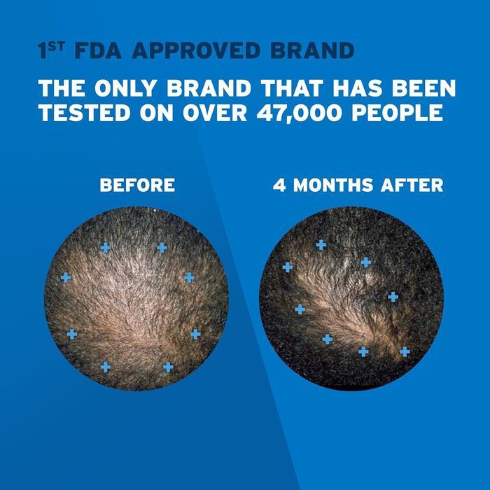 Rogaine Foam Minoxidil 5% For Men Original USA