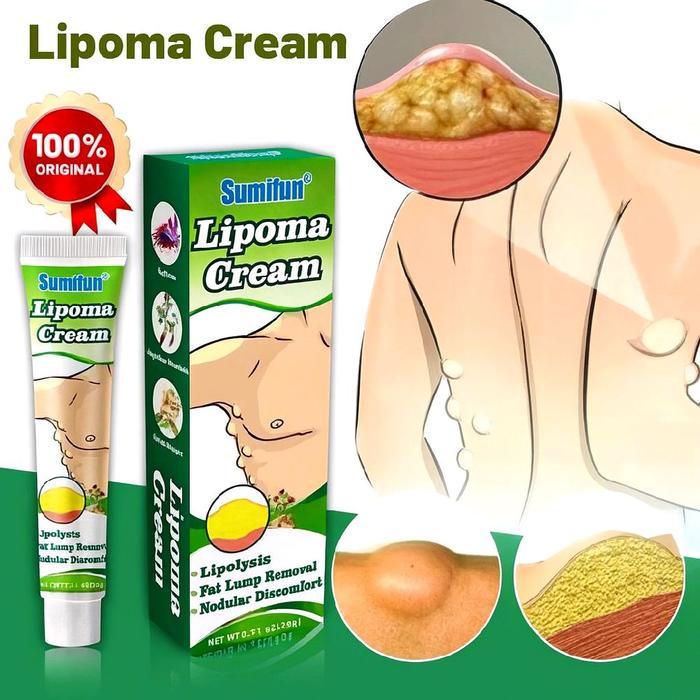 Original lipoma cream salep benjolan 100% Original Herbal Ampuh lipoma cream salep benjolan Gondok