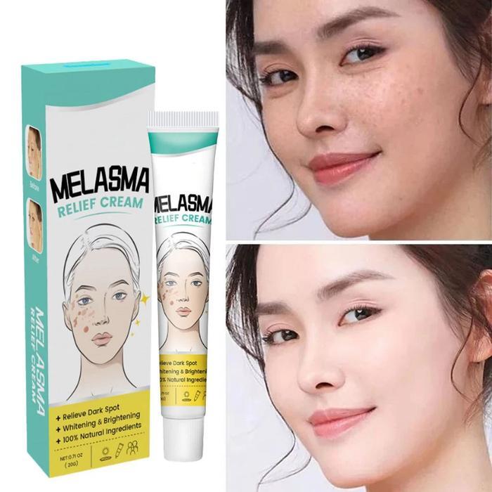 Cream penghilang flek hitam Bintik Melasma Penghapusan whitening Krim Penghilang Flek Hitam