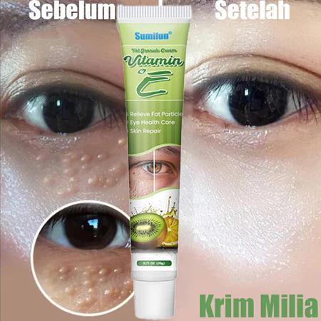 Krim Penghilang Milia Obat Milia Di Bawah Mata Cream Vitamin E Eye Cream Penghilang Milia Syringoma
