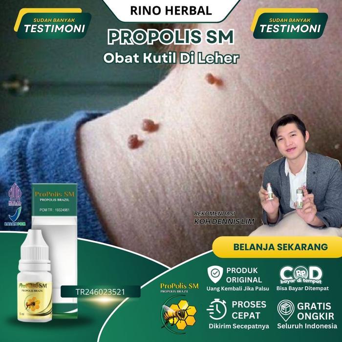 Obat Perontok Kutil Di Leher, Obat Kutil Di Leher, Obat Penghilang Kutil, Obat Daging Tumbuh, Obat