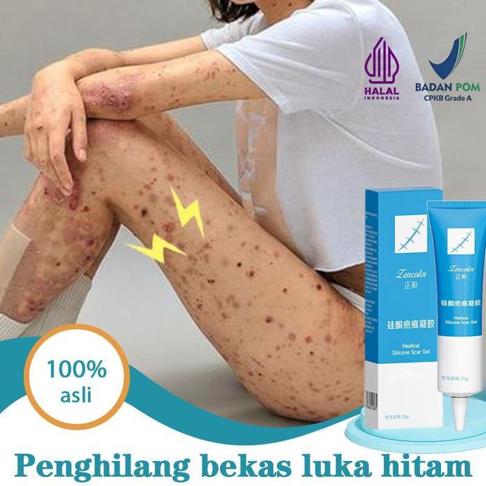 COD Gel bekas luka Penghilang bekas luka hitam koreng Penghilang bekas luka di kaki Penghilang Bekas