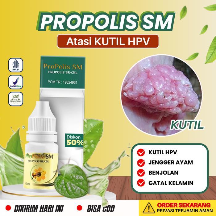 Perawatan Kutil HPV / Kutil Kelamin, Jengger Ayam, Kutil Anus, Benjolan Jerawat di Kelamin Untuk
