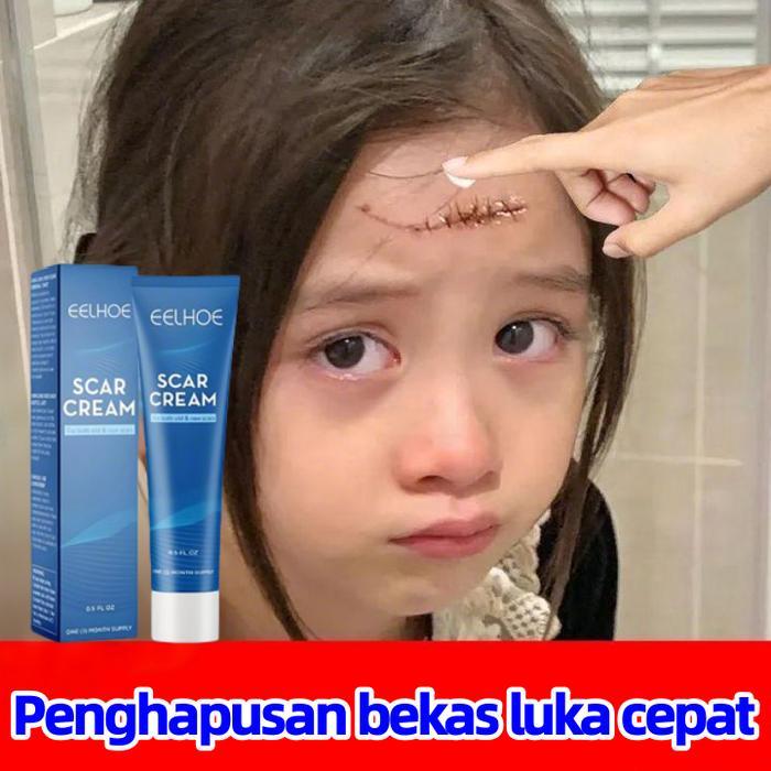 salep Penghilang bekas luka Penghilang bekas luka hitam koreng salep penghilang bekas luka obat