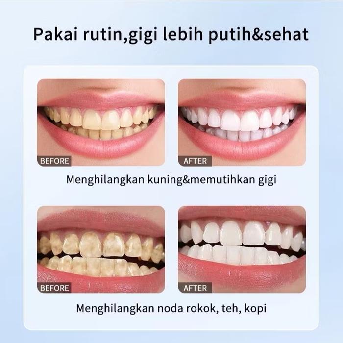 Sopami Sp-7 Pasta Gigi Pemutih Pembersih Plak & Perawatan Gusi Toothpaste Sp7 Probiotik Sp 7
