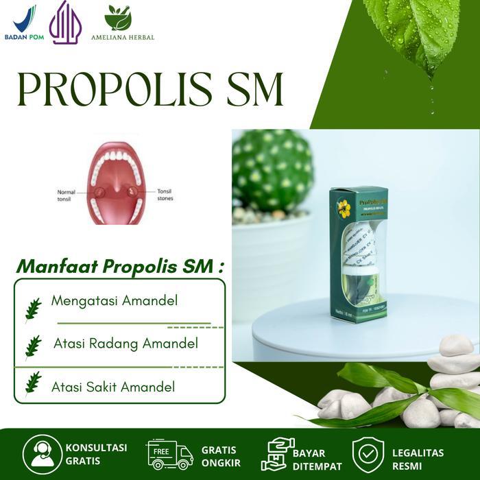 Propolis SM Membantu Atasi Amandel, Radang Amandel, Sakit Amandel, Amandel Membengkak, Amandel Parah