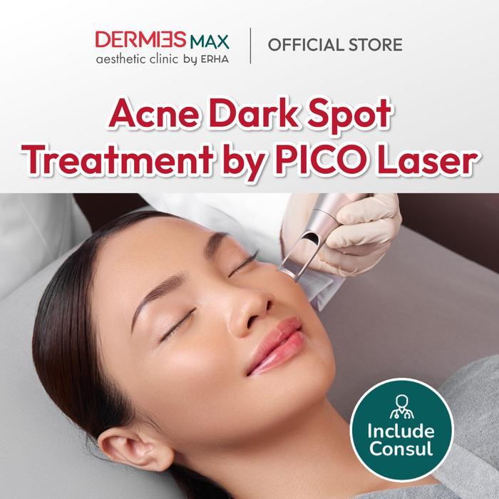 Dermies Max Acne Dark Spot Treatment by PICO Laser