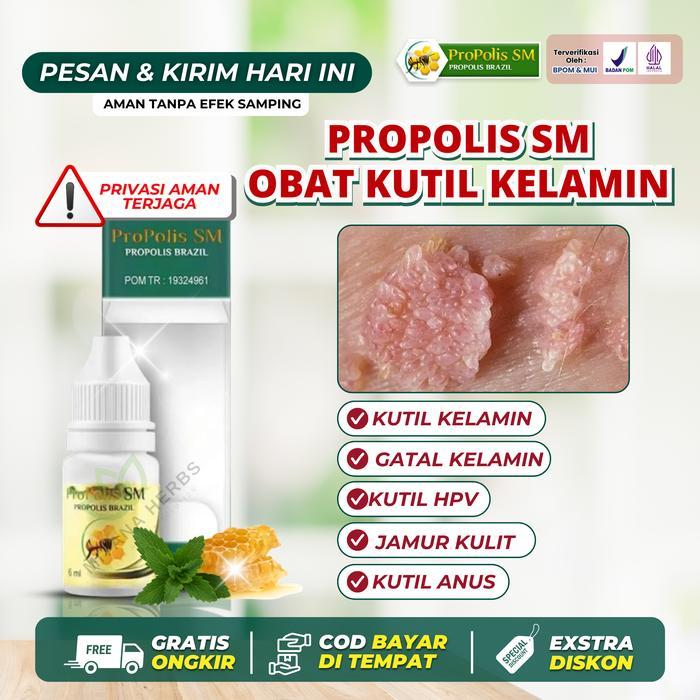ProPolis Sm Salep Cair Atasi Kutil Kelamin Daging Tumbuh Gatal Kelamin Pria Wanita Jamur Kelamin