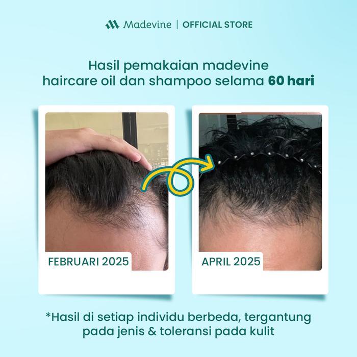 Madevine Hair Oil + Madevine Shampoo - Serum Dan Shampoo Bantu Atasi Penumbuh Rambut, Rambut Rontok
