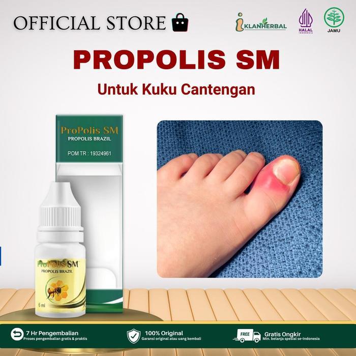 Propolis SM Brazilian 6ml Untuk Kuku Cantengan Bernanah Jamur Kuku Berair Kuku Bengkak Kutu Air Kaki