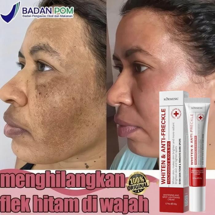 [BPOM] Cream Flek Hitam Membandel Cream Penghilang Flek Hitam 20g Krim Wajah Pencerah Anti Bintik