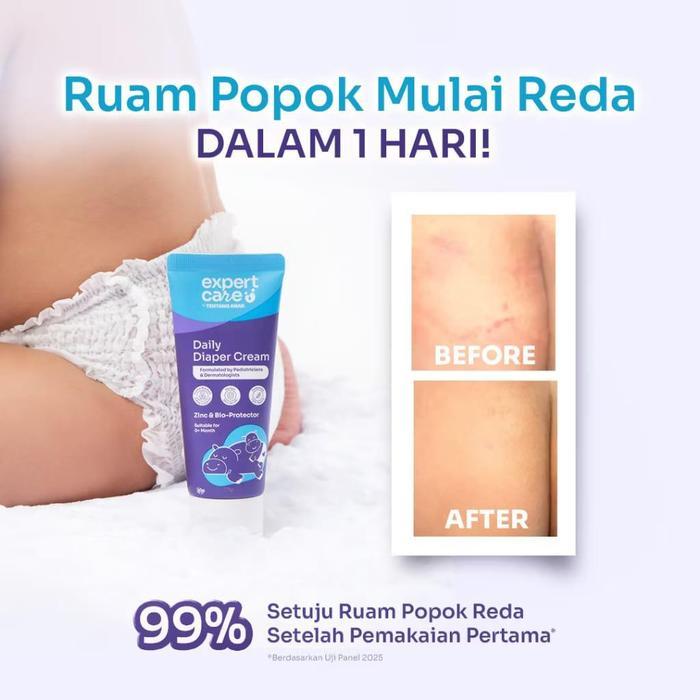 EXPERT CARE DIAPER RASH CREAM EXPERTCARE DAILY DIAPER CREAM 40G DENGAN ZINC OXIDE, PANTHENOL &