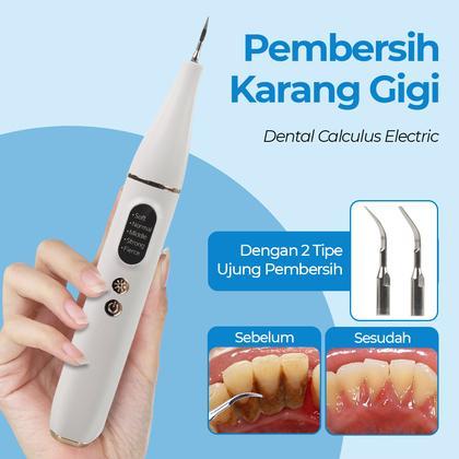 Alat Pembersih Karang Gigi Ultrasonik Elektrik, Efektif Hilangkan Plak dan Karang Gigi