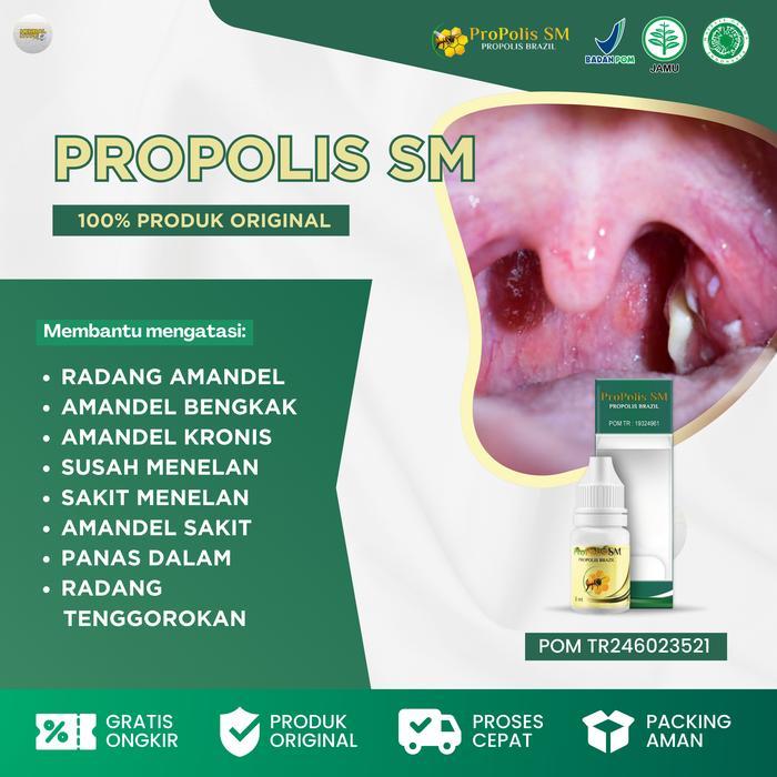 Propolis SM Herbal Amandel Anak Dan Dewasa Pengempis Amandel, Radang Amandel, Amandel Bengkak,