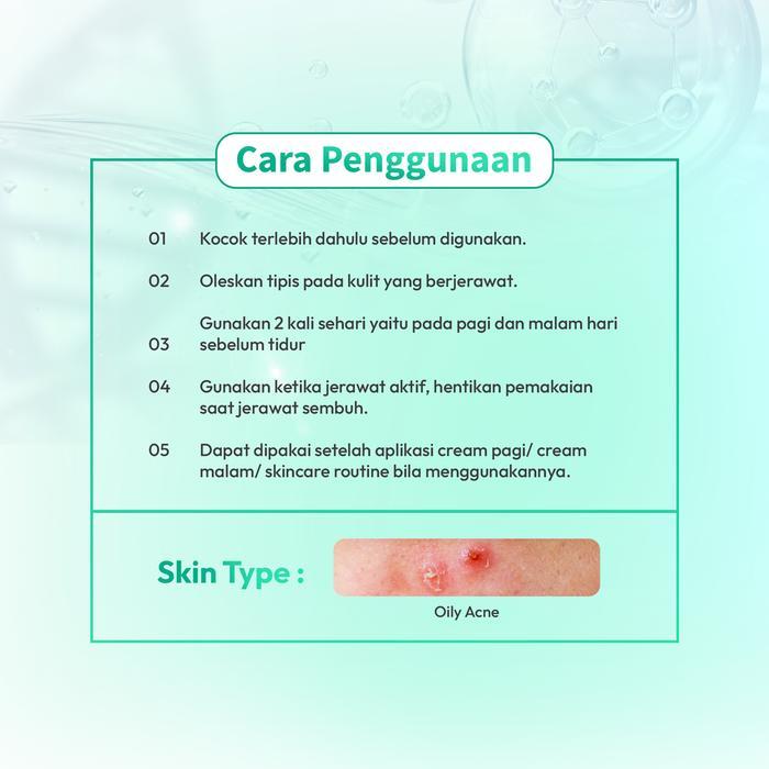 Larissa Treatment Lotion / Acne Spot ( Perawatan Muka Berminyak Berjerawat Meradang) Terlaris