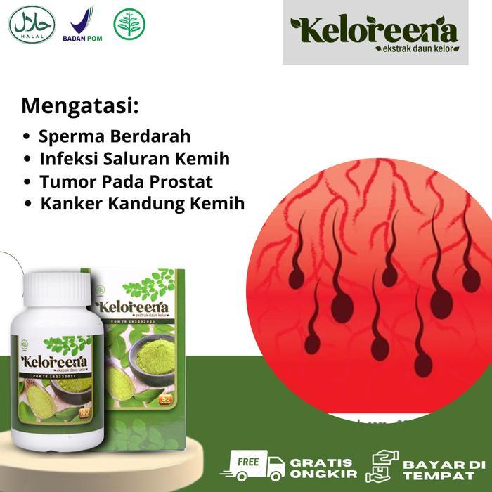 Obat Sperma Berdarah, Hematospermia, Kanker Kandung Kemih - Keloreena
