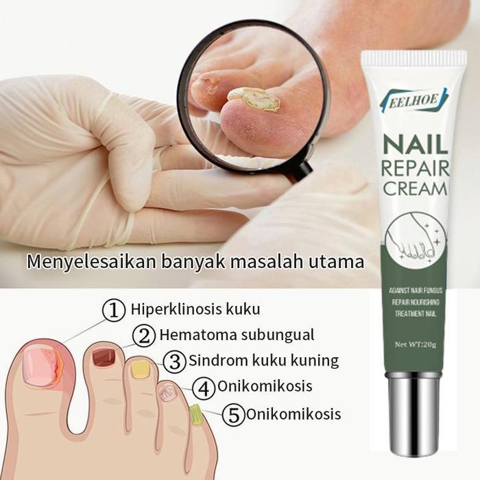 Obat Jamur Kuku Obat Jamur Dan Kuku Rusak Obat Jamur Kuku Kaki 20G Serum Kuku Obat Kuku Jamur Dan