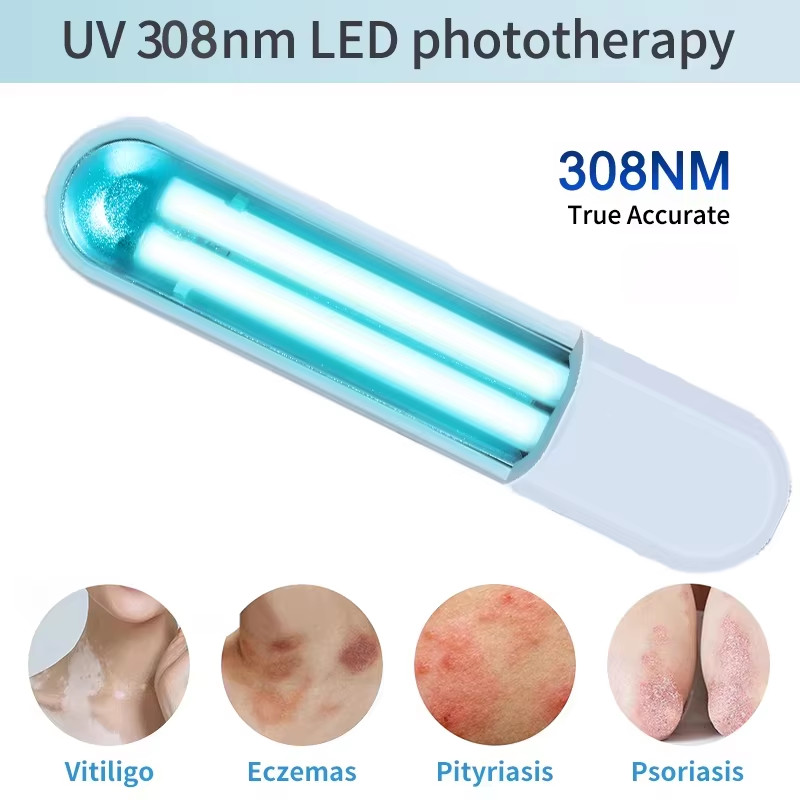 308nm Narrowband Uvb Phototherapy Instrument Anti-Vitiligo Treatment Psoriasis White Spot Skin Uvb