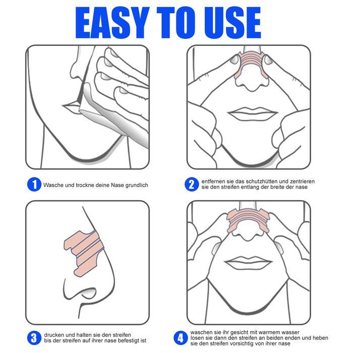 100% Asli/GrosirSouth Moon Plester Hidung 30pcs Plester Hidung Tersumbat Nasal Strips Untuk Hidung