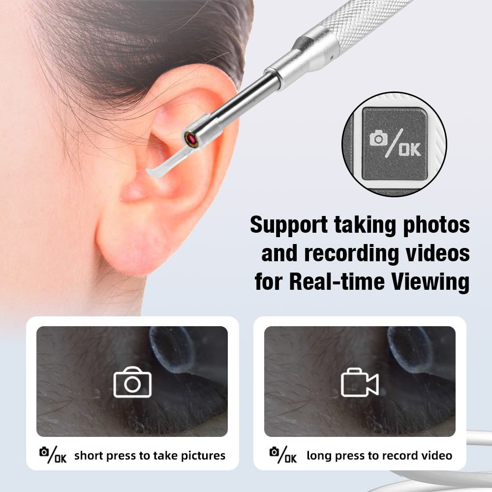 KERUI Otoscope 3.9mm Ear Endoscope Camera with 6 Lights 4.3 Inch Screen Ear Wax Removal Tool