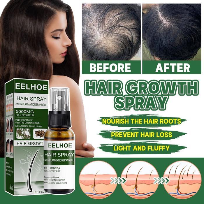 BERKUALITAS Penumbuh Rambut Botak Semprotan Penumbuh Rambut Obat Rambut Botak Serum Penumbuh Rambut