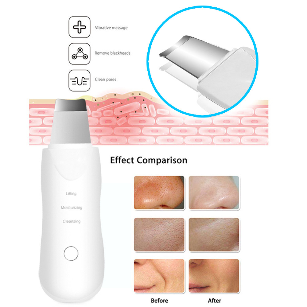 Ultrasonic Skin Scrubber Scrubber Deep Vibrate Facial Cleaner Shovel Face Scrubber Peeling Black