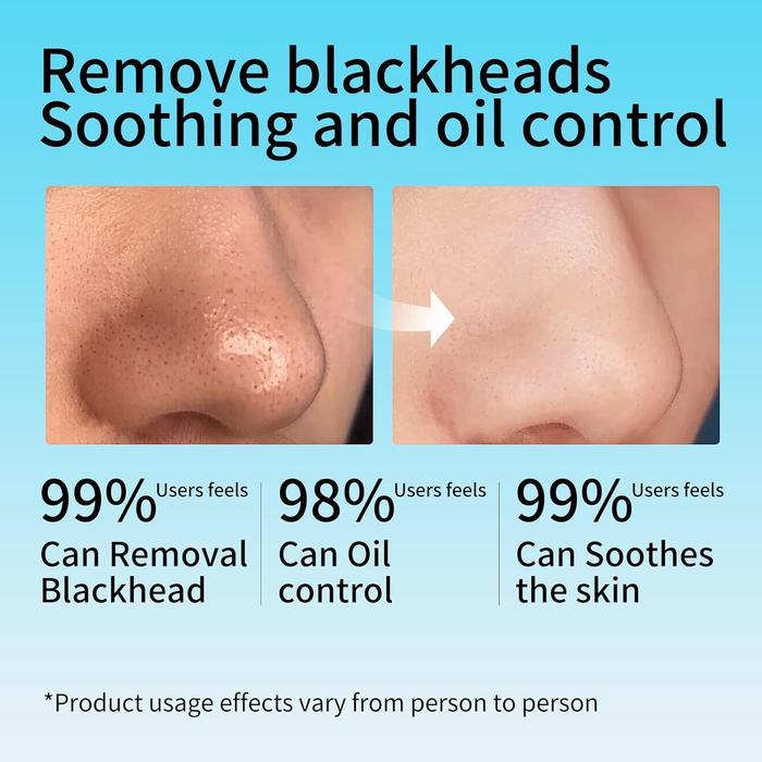 DISKON RTOPR BLACKHEAD MASK & PAPER PENGANGKAT KOMEDO HIDUNG PEMBERSIH PORI REMOVER KOMEDO