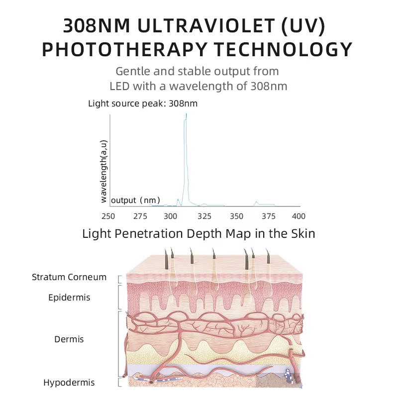 Uvb Phototherapy Lamp Light Therapy Eximer lase Vitiligo 308nm Home Medical UV Excimer lase 308nm