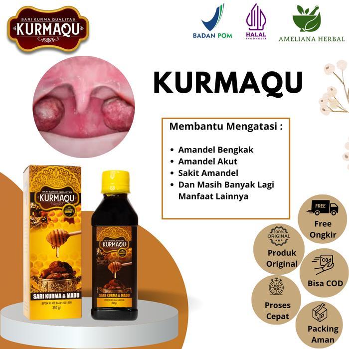 Kurmaqu Untuk Atasi Amandel Bengkak Amandel Akut Sakit Amandel