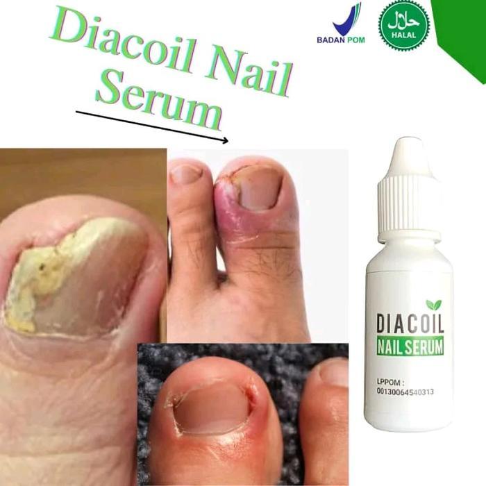 Minyak Diacoil Nail Serum Perawatan Kuku